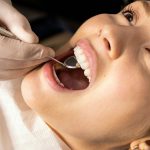 Root Canals vs Tooth Extractions