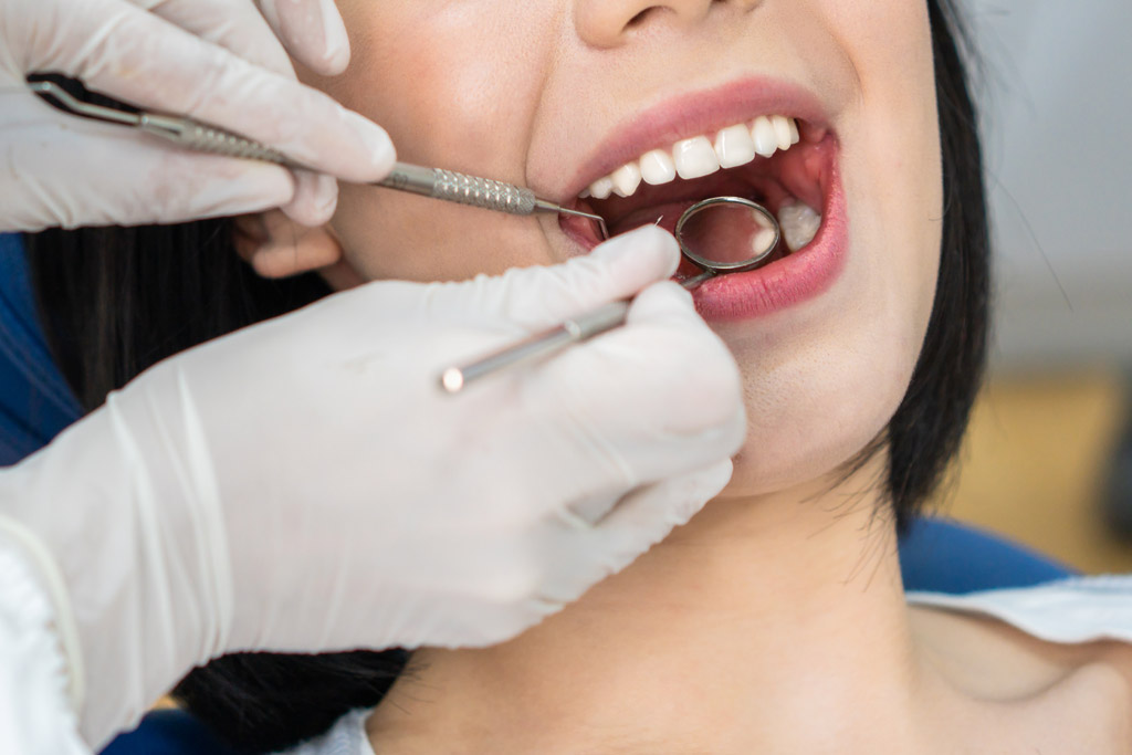 How Cavities Form: FAQs